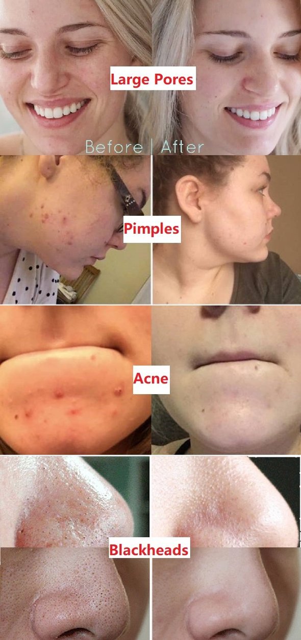 HZA™Natural Green Tea Clay Mask Stick– Clears Acne & Refines Pores🌿