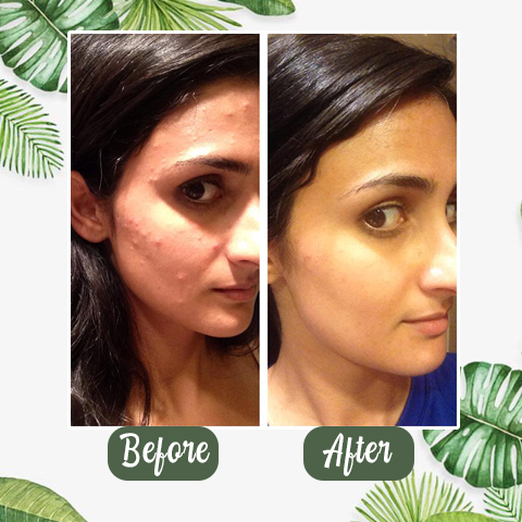 HZA™Natural Green Tea Clay Mask Stick– Clears Acne & Refines Pores🌿