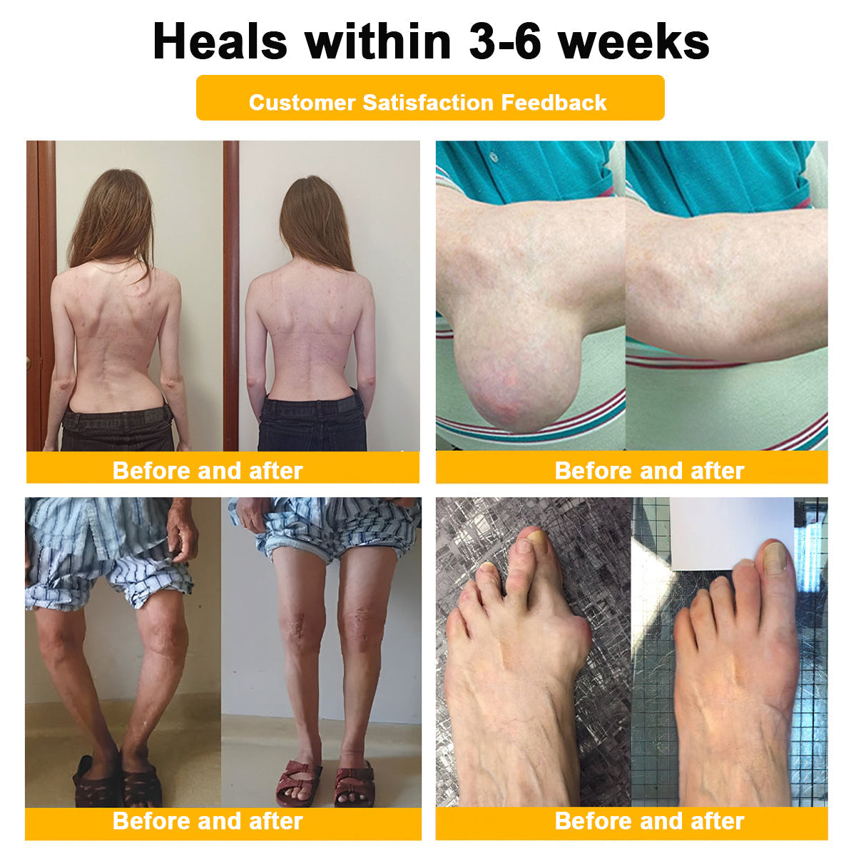 🐝AQA™ Botulinum & Bee Essence Pain Relief Bone Healing Cream