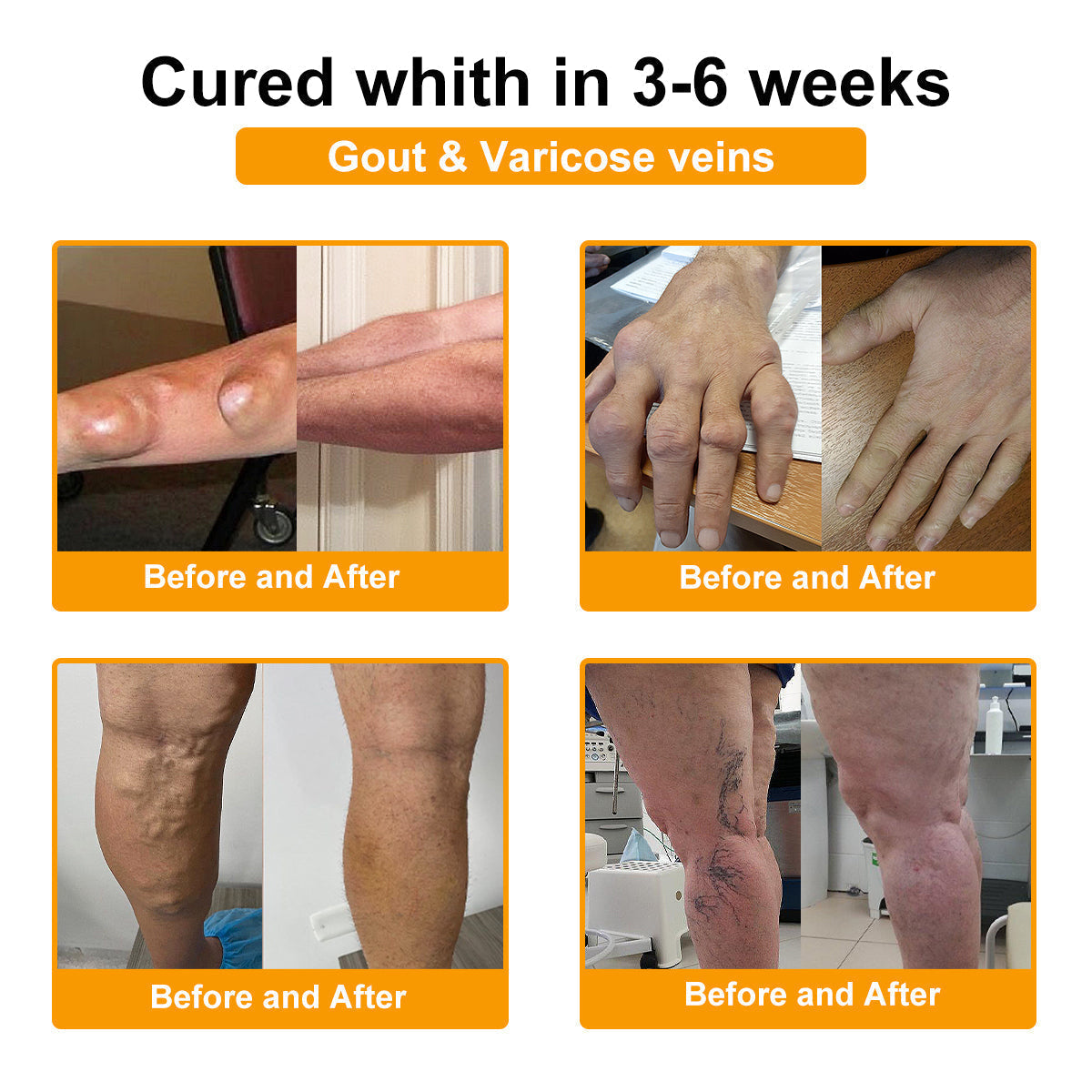 🐝AQA™ Botulinum & Bee Essence Pain Relief Bone Healing Cream