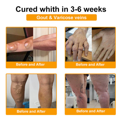 🐝AQA™ Botulinum & Bee Essence Pain Relief Bone Healing Cream