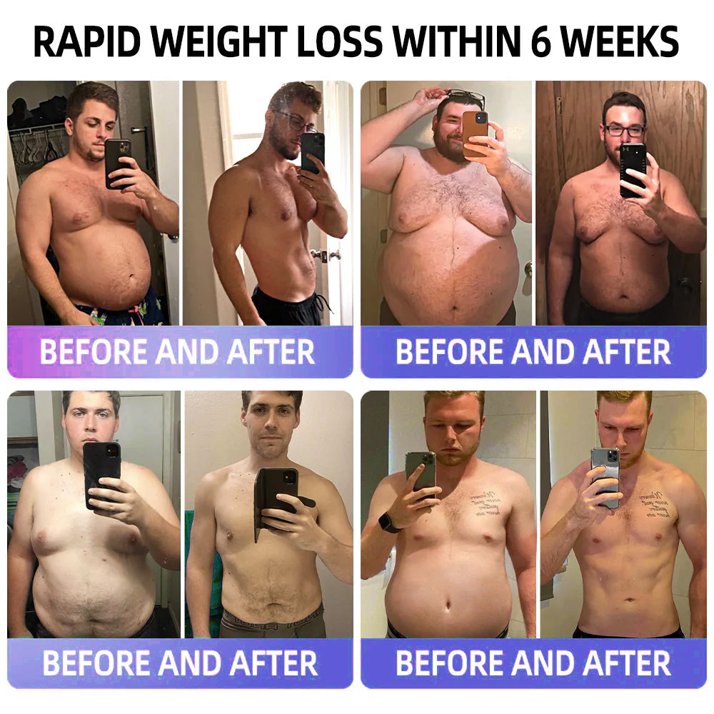 BBOJI  GLP-1 Apamin Slimming & Detox Health Booster Drops💎(𝐅𝐨𝐨𝐝-𝐠𝐫𝐚𝐝𝐞 𝐟𝐚𝐭 𝐛𝐮𝐫𝐧𝐞𝐫 - 𝐃𝐞𝐯𝐞𝐥𝐨𝐩𝐞𝐝 𝐛𝐲 𝐓𝐡𝐞 𝐨𝐛𝐞𝐬𝐢𝐭𝐲 𝐬𝐨𝐜𝐢𝐞𝐭𝐲)💎