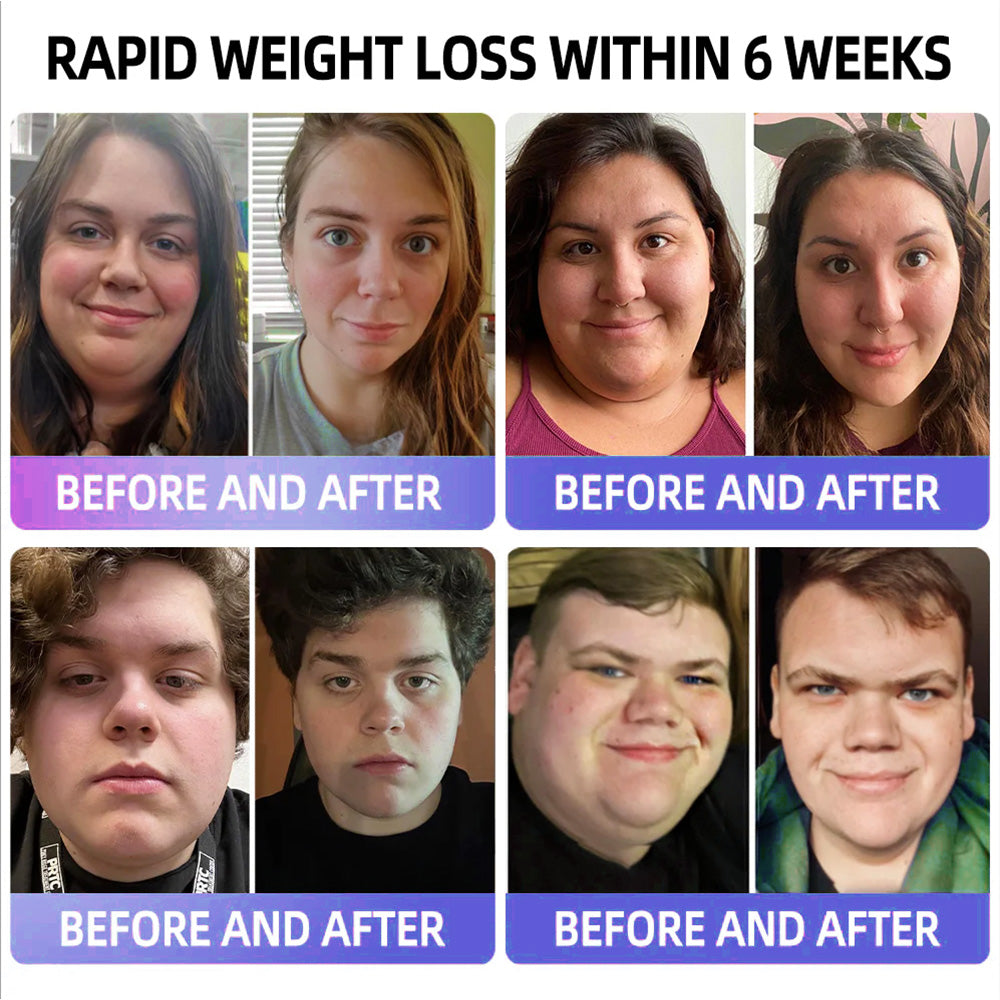 BBOJI  GLP-1 Apamin Slimming & Detox Health Booster Drops💎(𝐅𝐨𝐨𝐝-𝐠𝐫𝐚𝐝𝐞 𝐟𝐚𝐭 𝐛𝐮𝐫𝐧𝐞𝐫 - 𝐃𝐞𝐯𝐞𝐥𝐨𝐩𝐞𝐝 𝐛𝐲 𝐓𝐡𝐞 𝐨𝐛𝐞𝐬𝐢𝐭𝐲 𝐬𝐨𝐜𝐢𝐞𝐭𝐲)💎