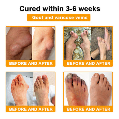 🐝AQA™ Botulinum & Bee Essence Pain Relief Bone Healing Cream