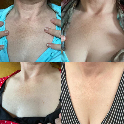 ✨Fast Dark Spot Remover-AQA™  Melanin Correcting Facial Serum(🔥Last Day Promotion 60% OFF)