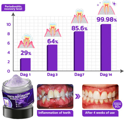 BBOJI™ (ADA recommended)Teeth Restoration Mineral Powder💎(𝐋𝐢𝐦𝐢𝐭𝐞𝐝 𝐭𝐢𝐦𝐞 𝐝𝐢𝐬𝐜𝐨𝐮𝐧𝐭 𝐋𝐚𝐬𝐭 𝟑𝟎 𝐦𝐢𝐧𝐮𝐭𝐞𝐬⏰)